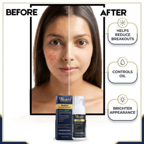 Bcari DotOut Foaming Face Wash